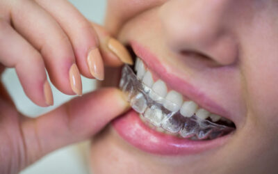 INVISALIGN